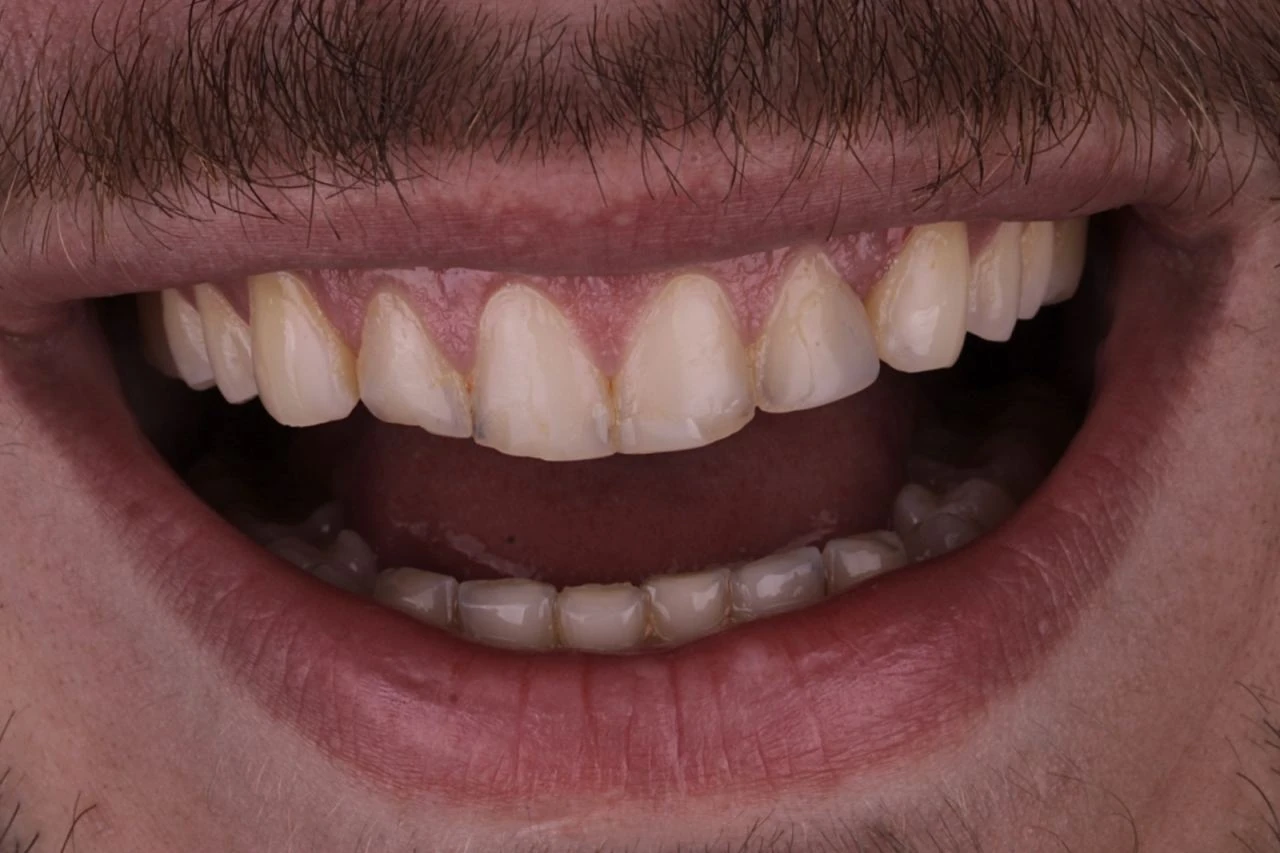 Sorriso antes do tratamento